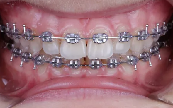 Стоматология Brillant Dental